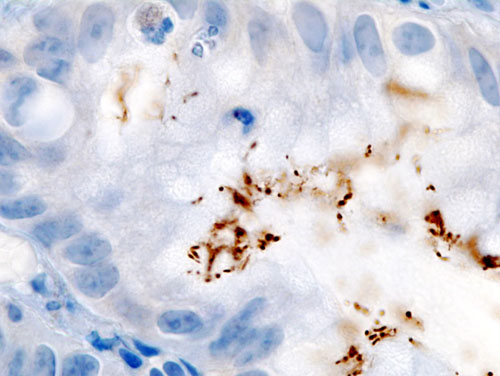 Helicobacter pylori pod mikroskopem. 
