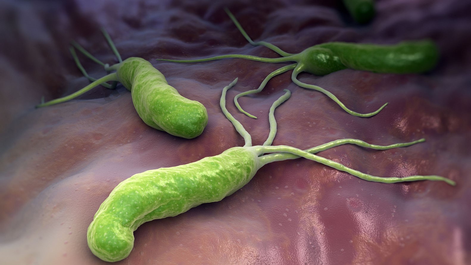 Test oddechowy helicobacter pylori